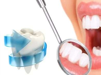 Реминерализующая терапия: щит для ваших зубов